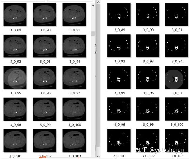 如何使用深度学习框架pytorch训练使用——胸腹部骨骼分割ct数据集:骨