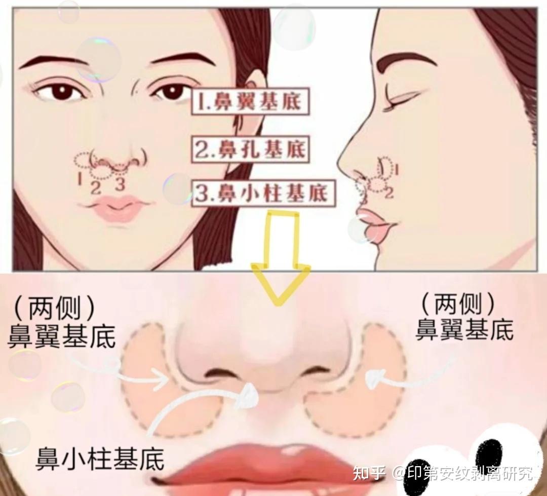 鼻基底凹陷的自测方法 - 知乎