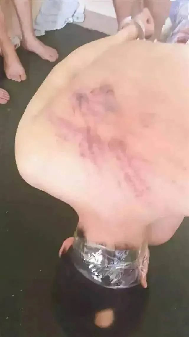 缅北「诈骗人员」被打