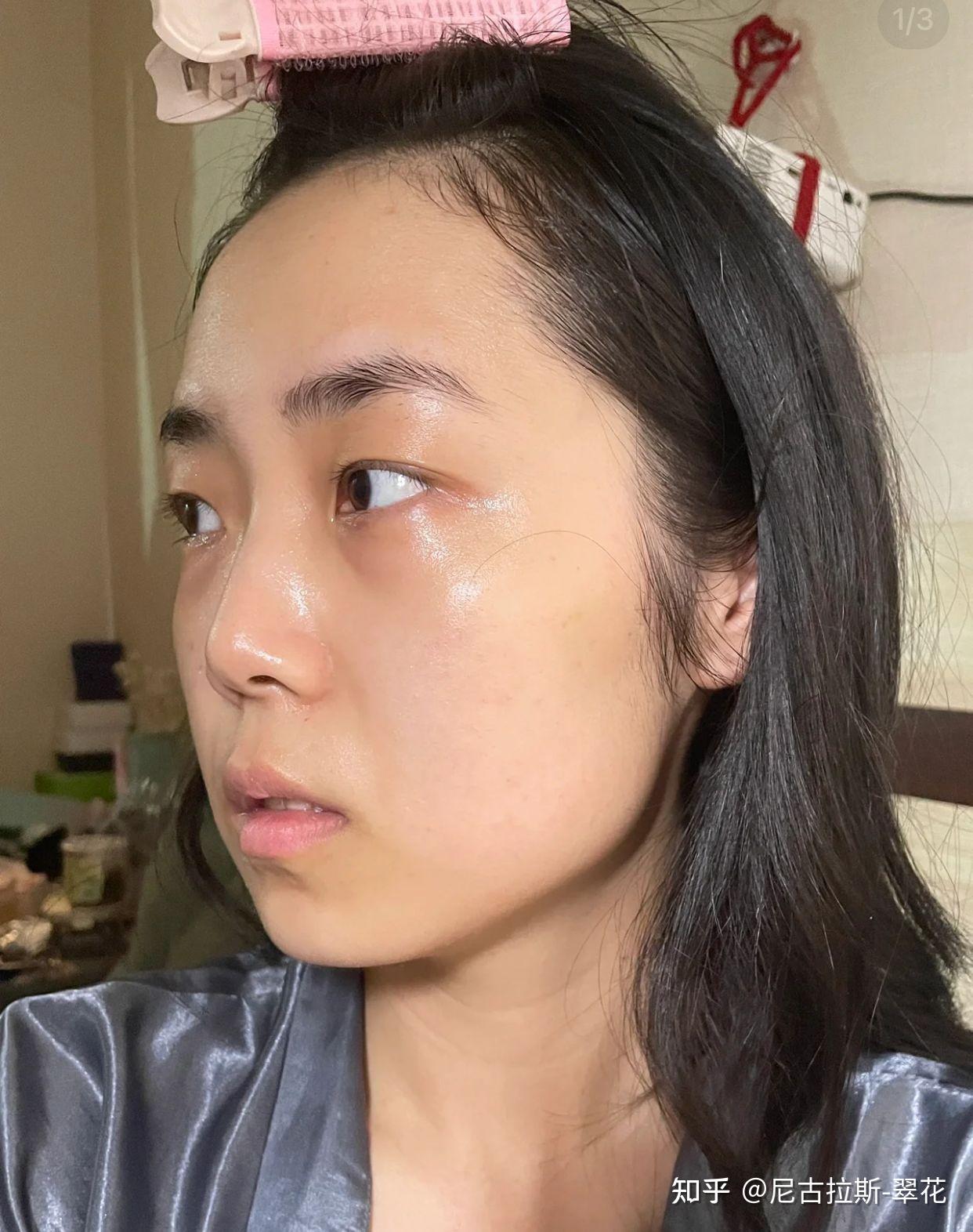 夏天晒成黑鬼了!急需美白!持证上岗的美白精华真的有用吗? - 知乎