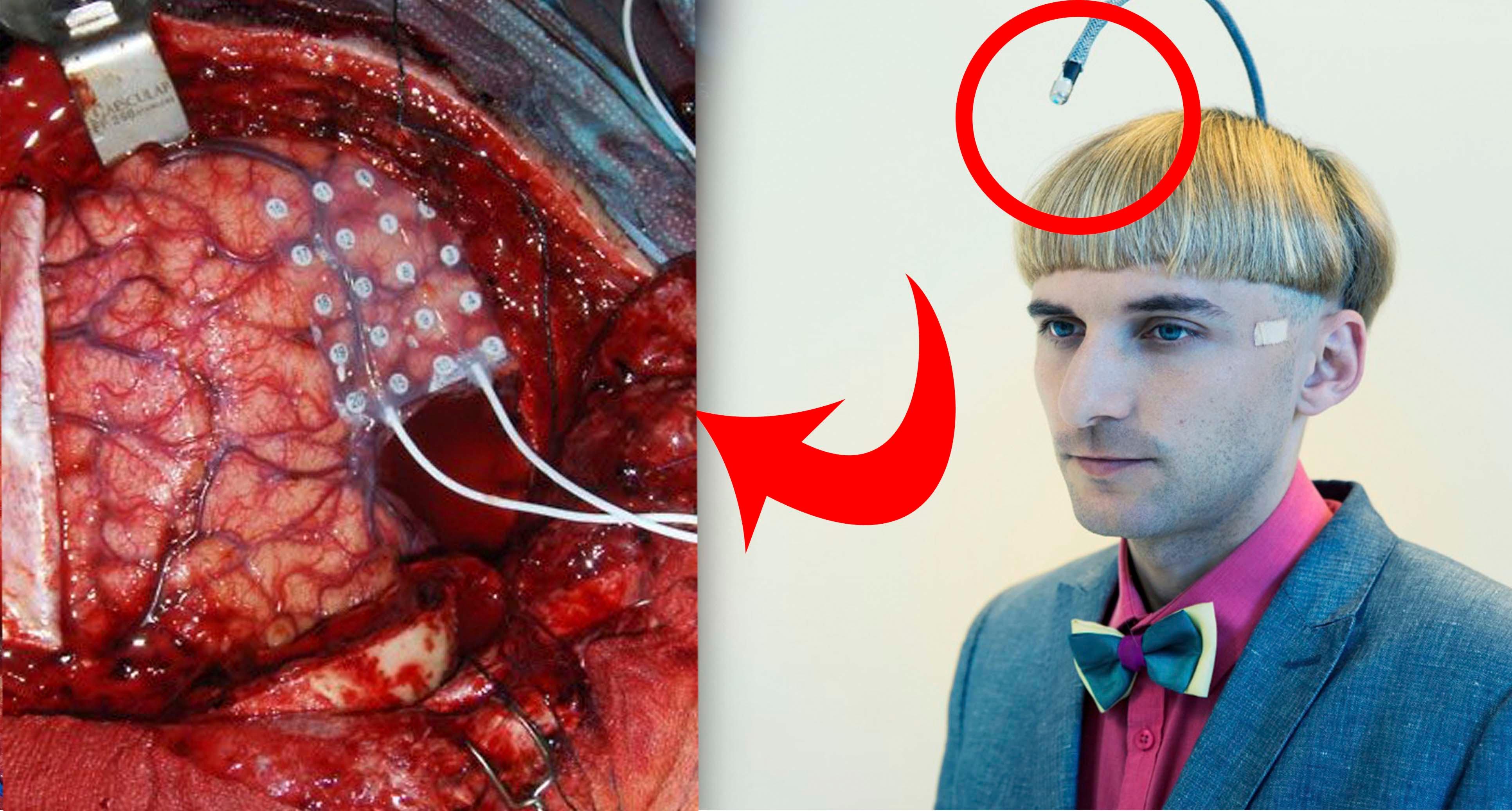 如何看待yy的李学凌给自己身体植入芯片