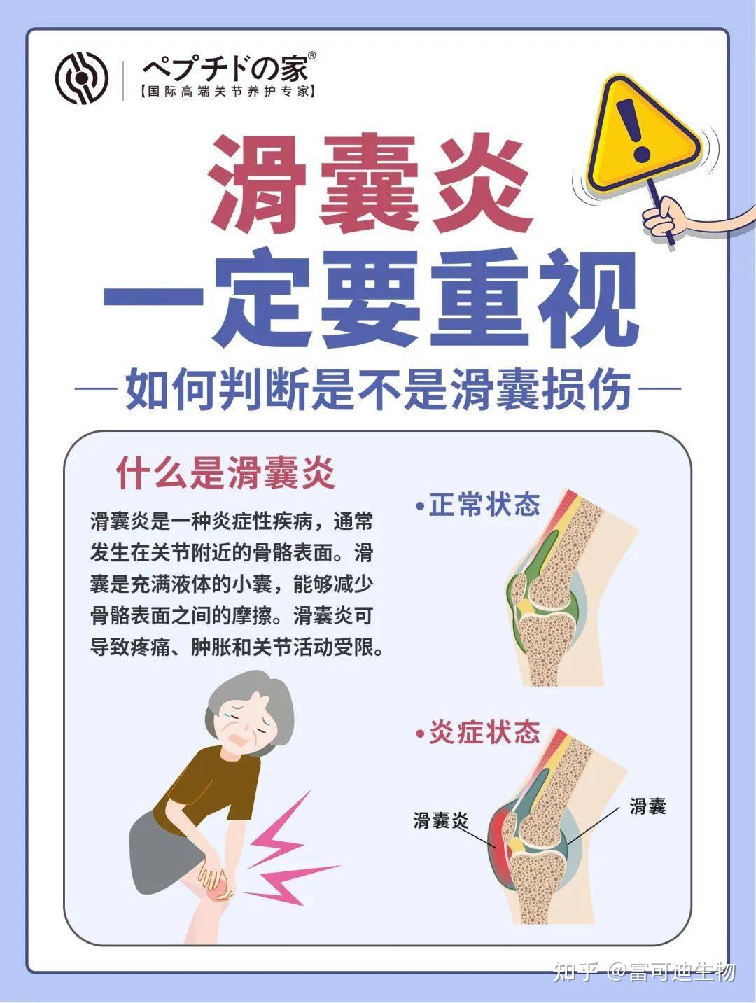 滑囊炎的发生原因是什么? - 知乎