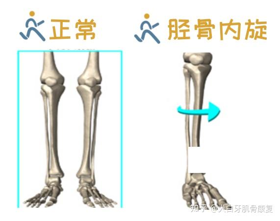 v2-903ce13c1ebc346b8fa91bcb847c14f0_r.jpg
