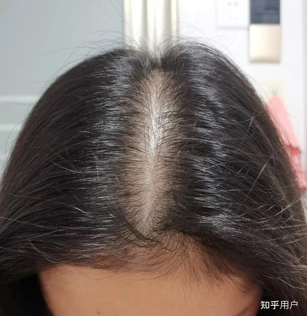头发多的女生都是怎么养发育发的? - 知乎