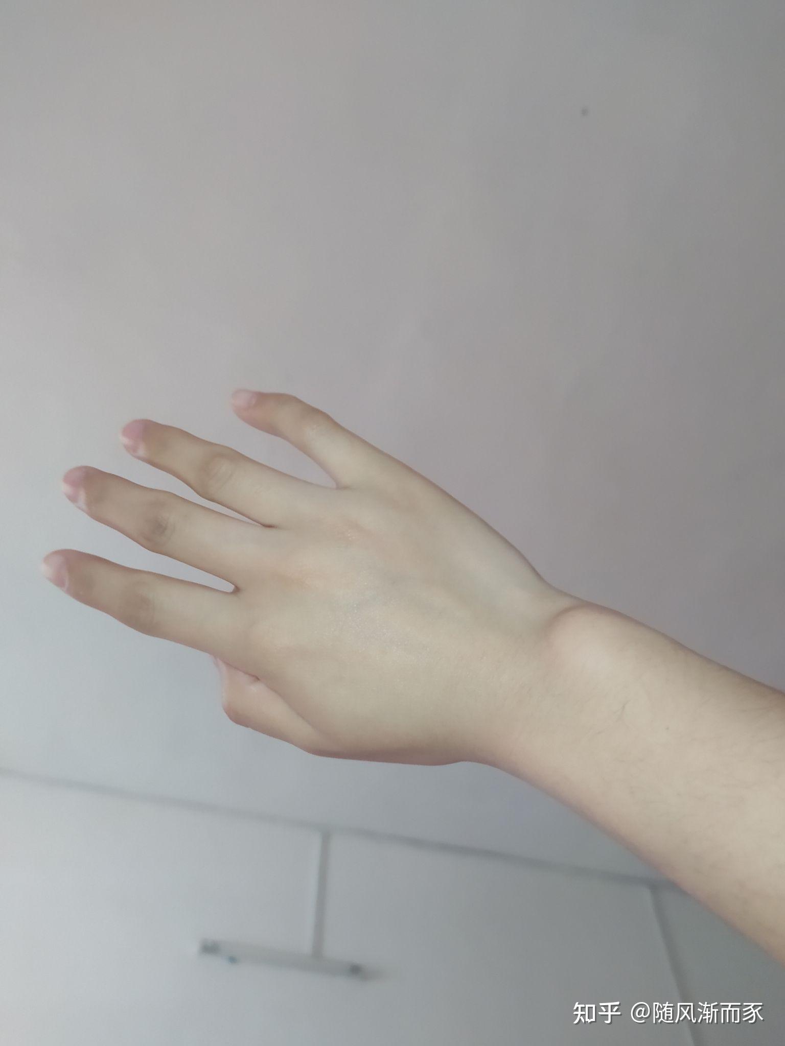 为啥我的手腕处又块骨头突起啊是手腕外侧靠近小指而且左右手都有好久