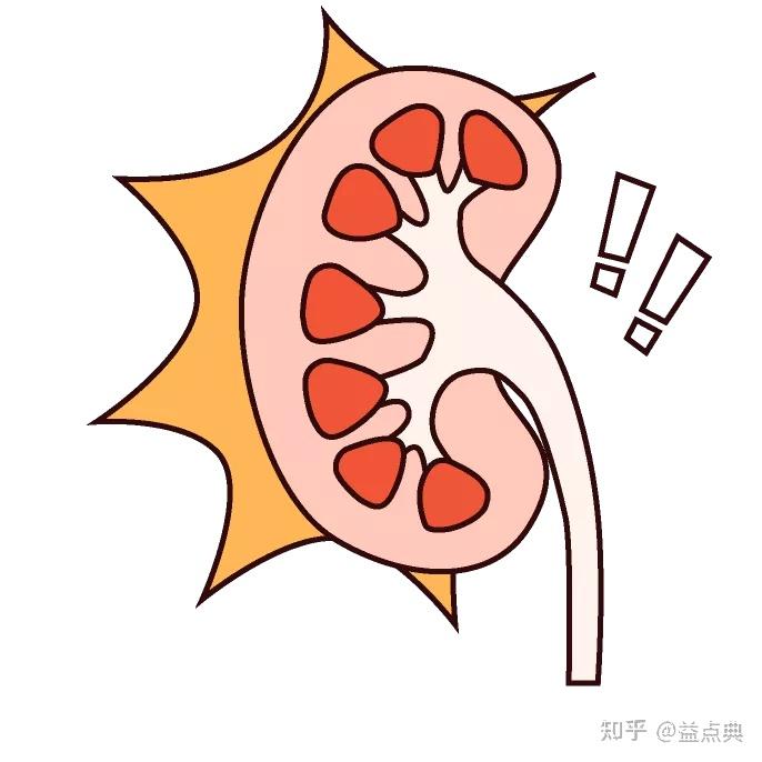 慢病数据库慢性肾小球肾炎科普