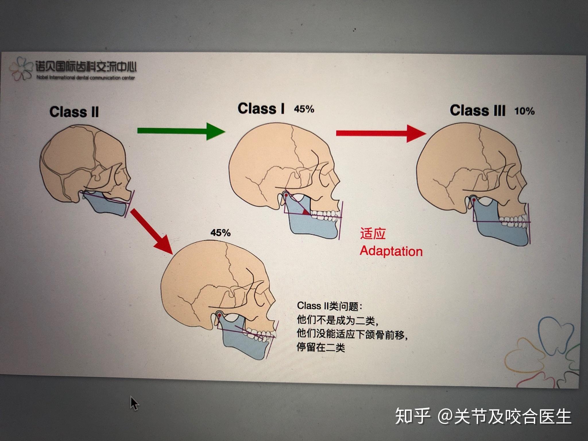 颌骨在哪里发育不良图片