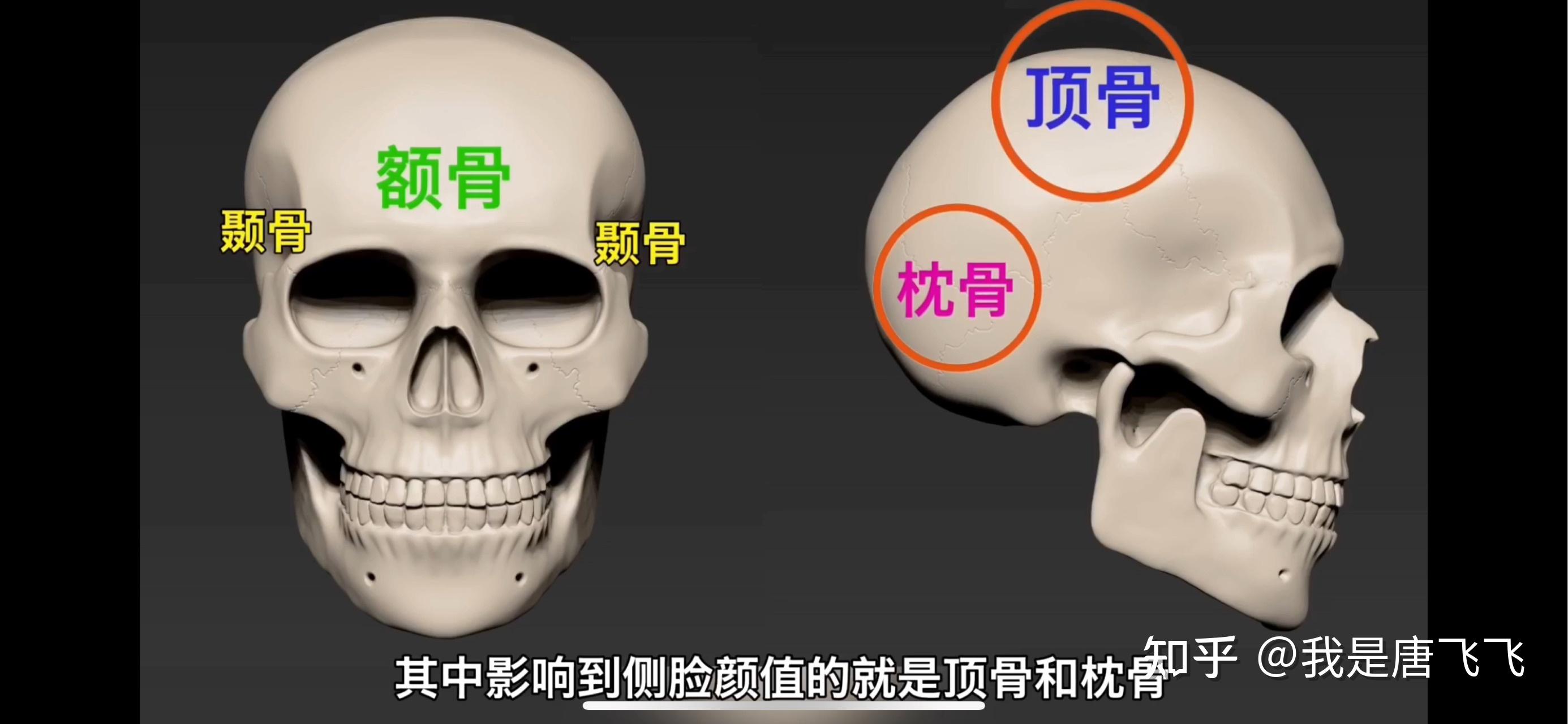 我们的头盖骨主要由4种骨头构成,分别是顶骨,枕骨,额骨和颞骨,其中
