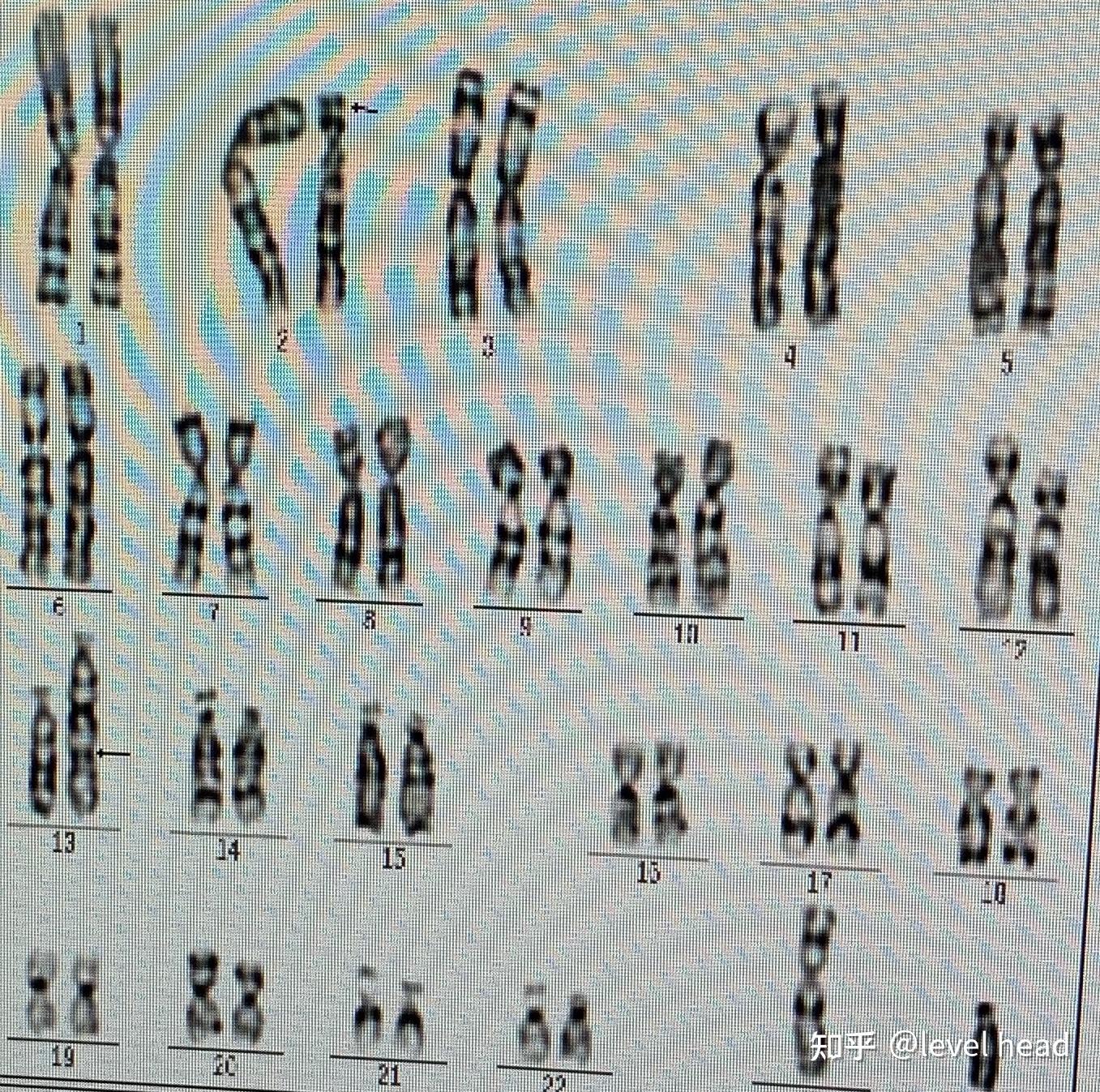zw染色体图片