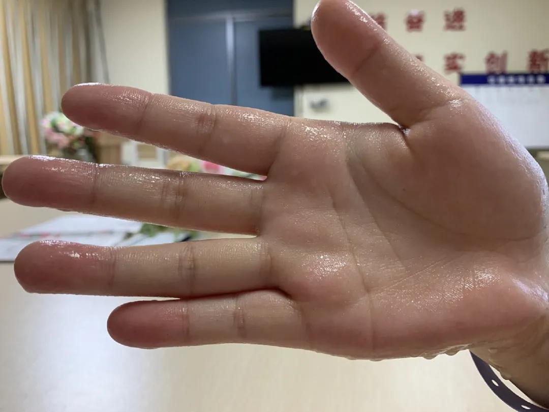 手脚心出汗 zhuanlan.zhihu.com