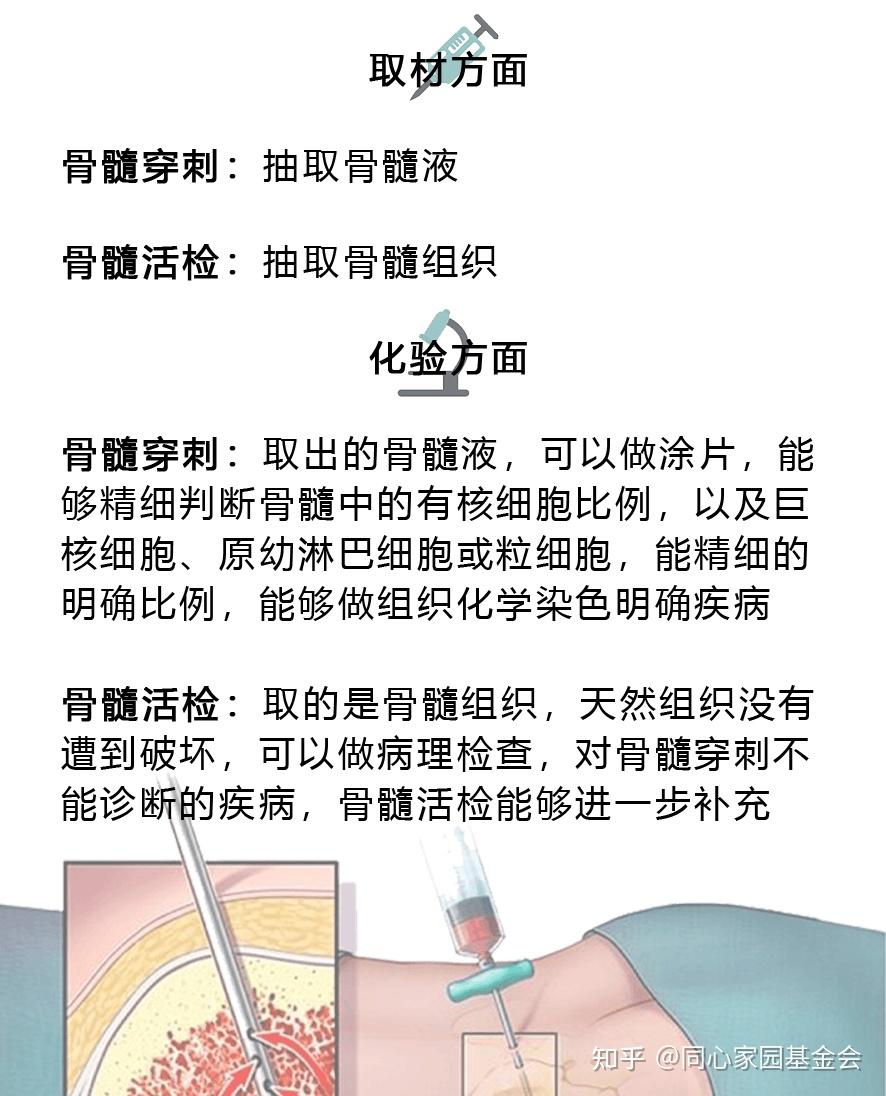 虽然骨髓穿刺和骨髓活检都需要用穿刺针抽取骨髓部分样本