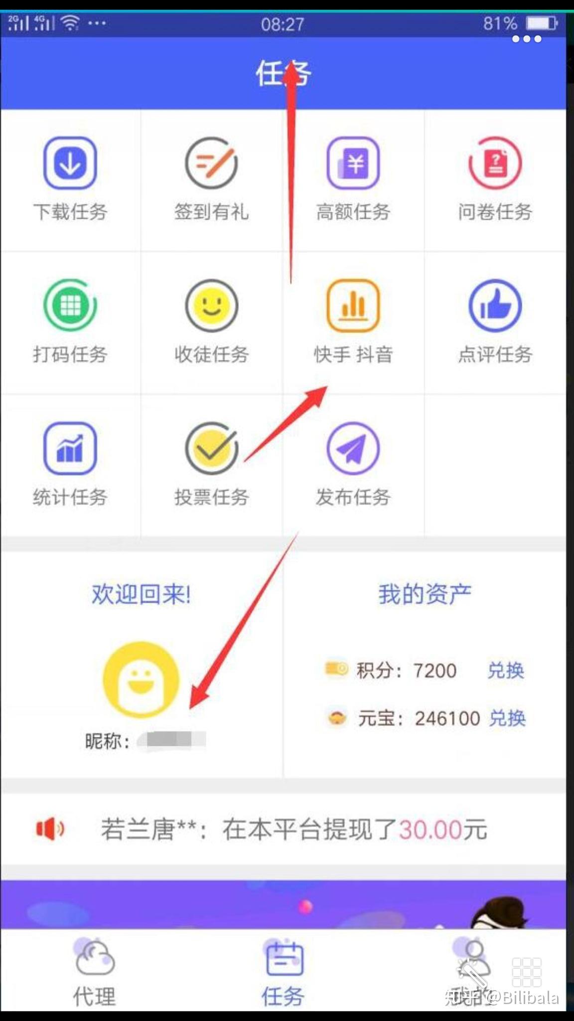 抖音免费赞怎么点(抖音免费赞怎么点赞)
