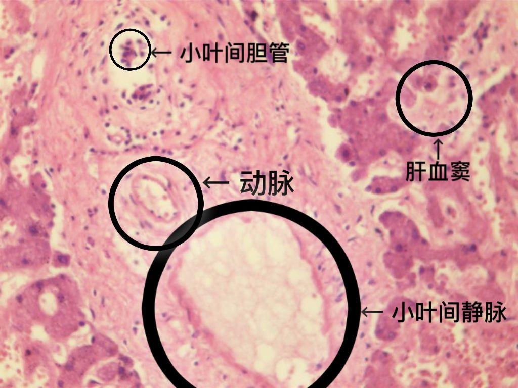 肝血窦组胚图图片