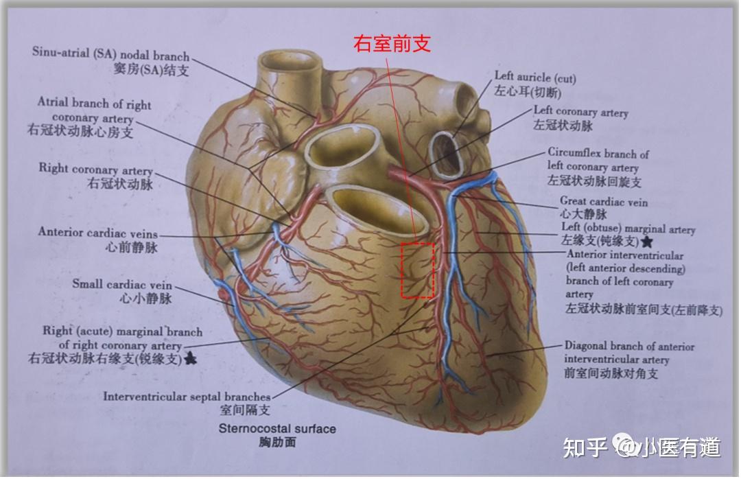 肺动脉圆锥部图片