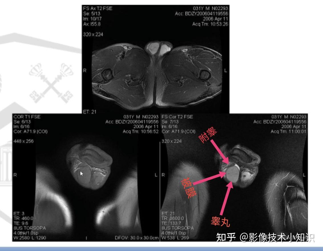 男性生殖系统解剖 - 知乎