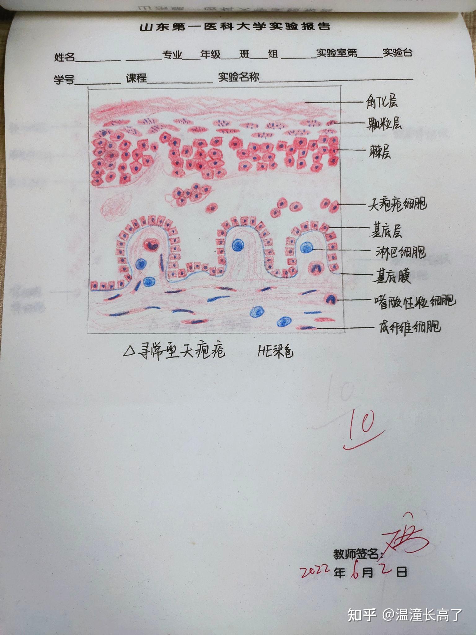 钟状期成釉器红蓝铅笔图片