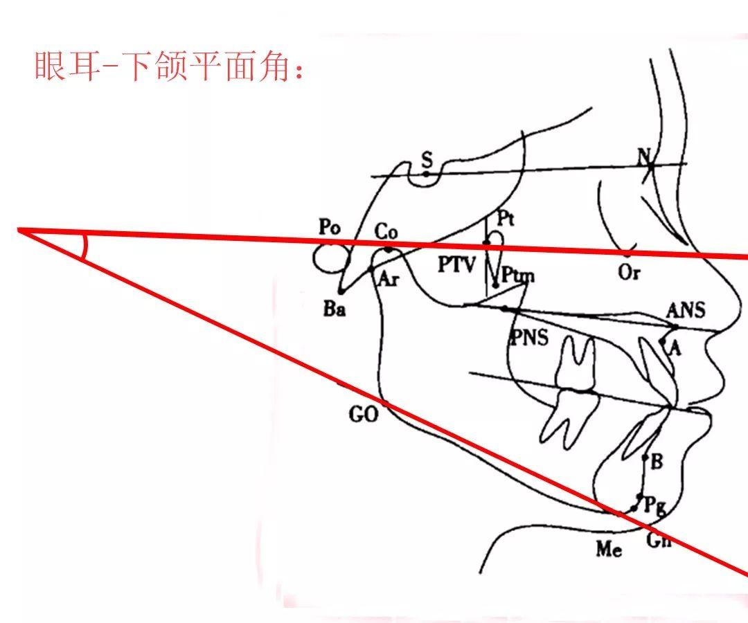 牙齿矫正期间的高角和低角面型是如何判定的?