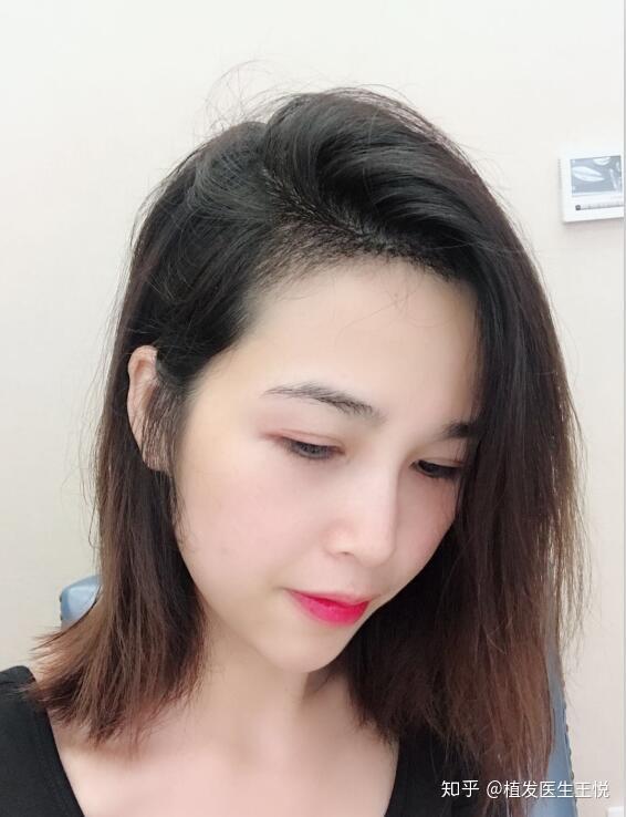 作为女生你是怎样秃的ω