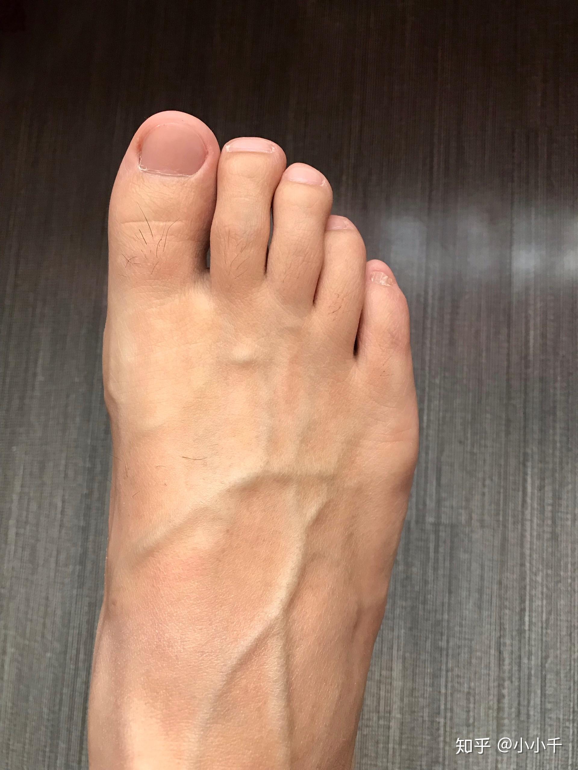 男生的脚什么样算好看