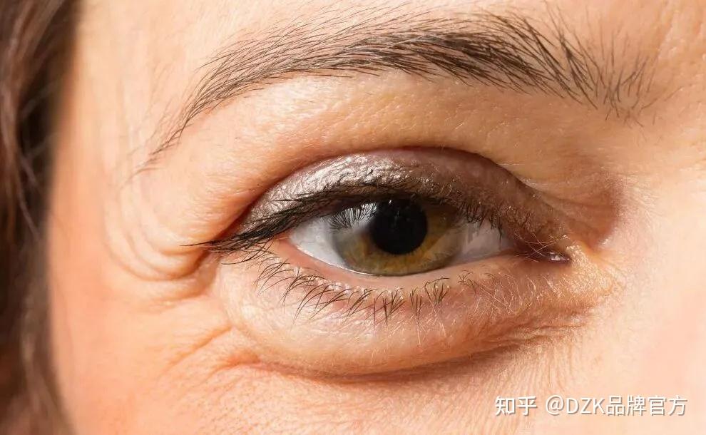 眼袋深显老教你两招轻松祛除