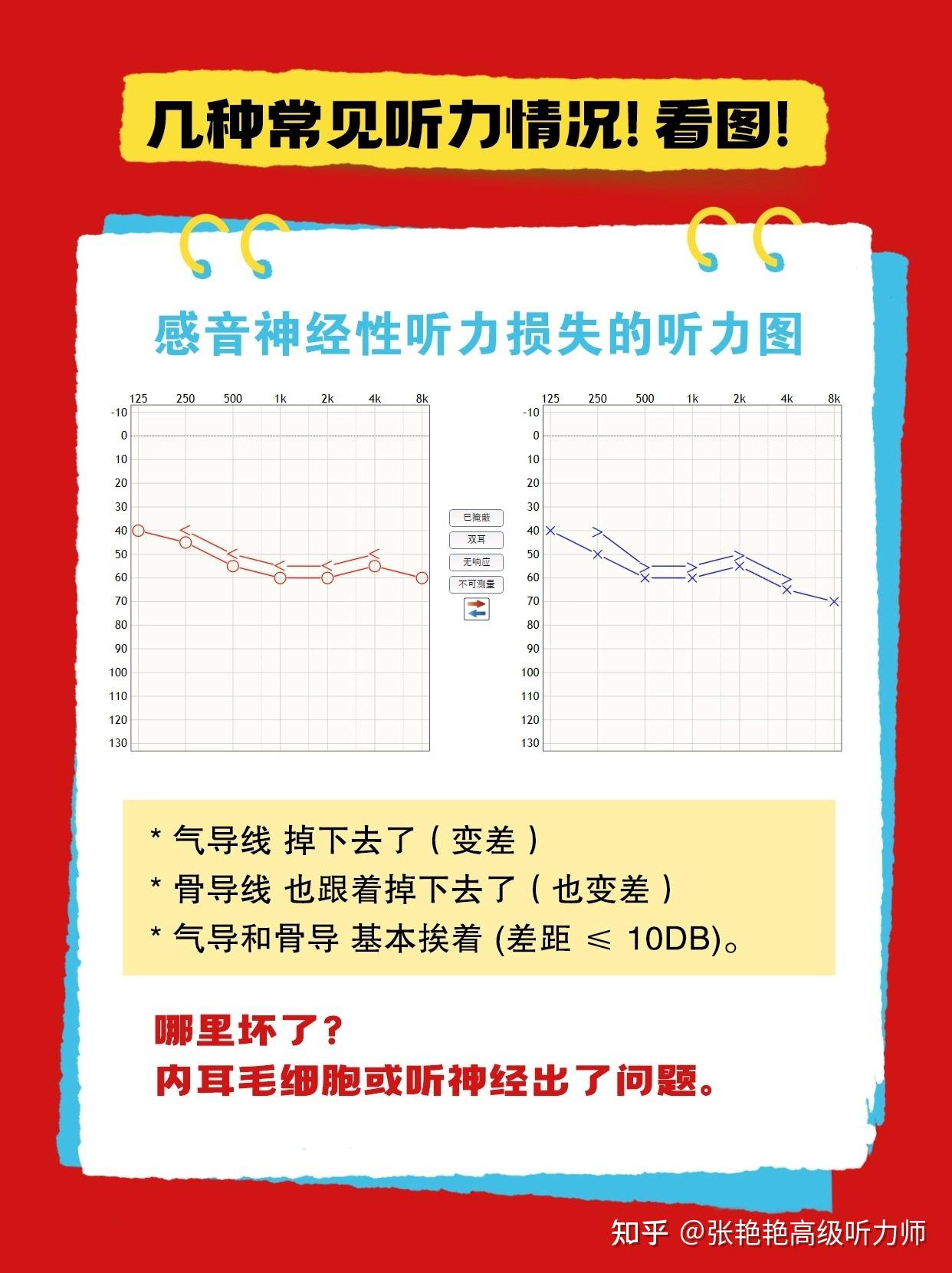 如何看懂听力图？保姆级教程 - 知乎