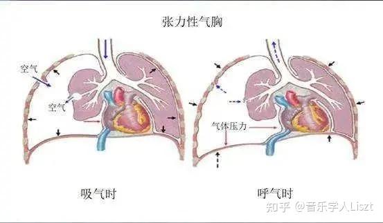 唱歌时横膈膜的状态图图片