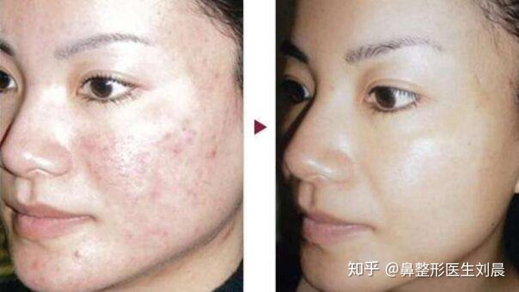 皮肤保养项目推荐 v2-92888bb6a02b417fd6a713cca523eb48_r.jpg