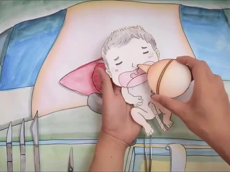 动画演示剖宫产生下宝宝全过程你敢坚持看完吗