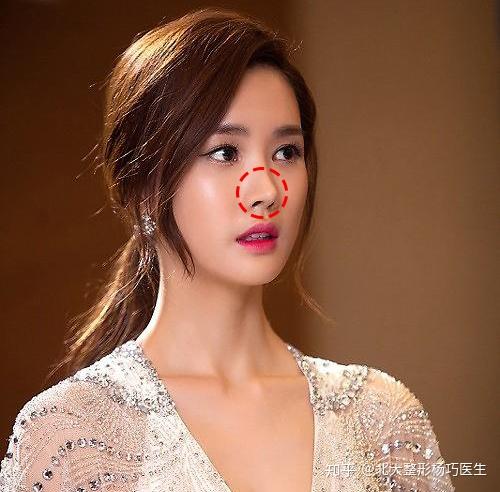 好看的鼻子千千万自然妈生鼻谁都爱