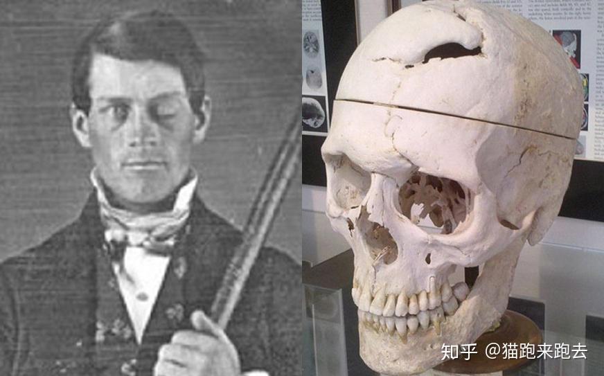掀起你的头盖骨丨被一根铁夯改变的菲尼亚斯盖奇