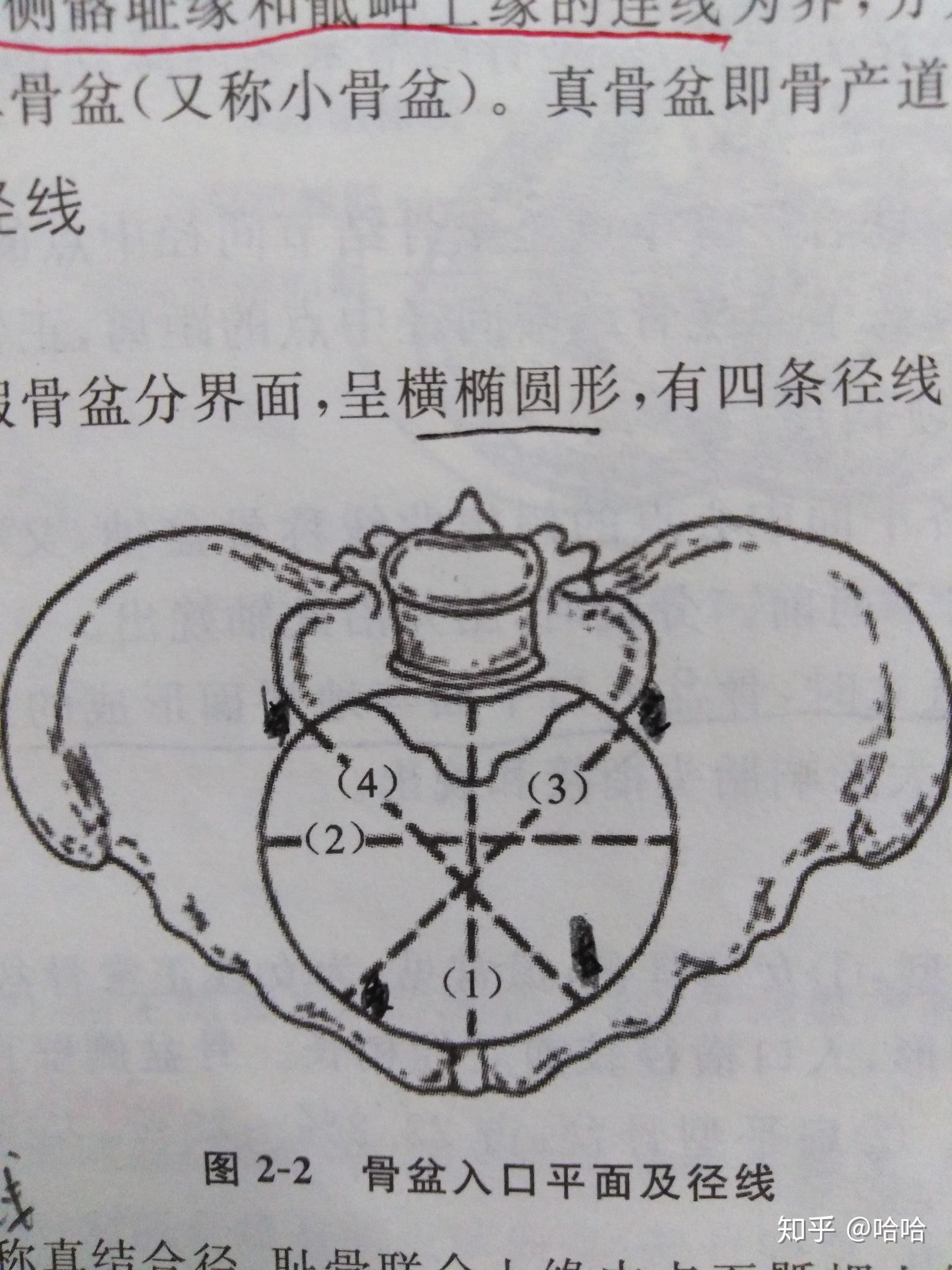 骨盆入口斜徑怎麼區分左右斜徑哪條線是左斜徑哪條線是右斜徑