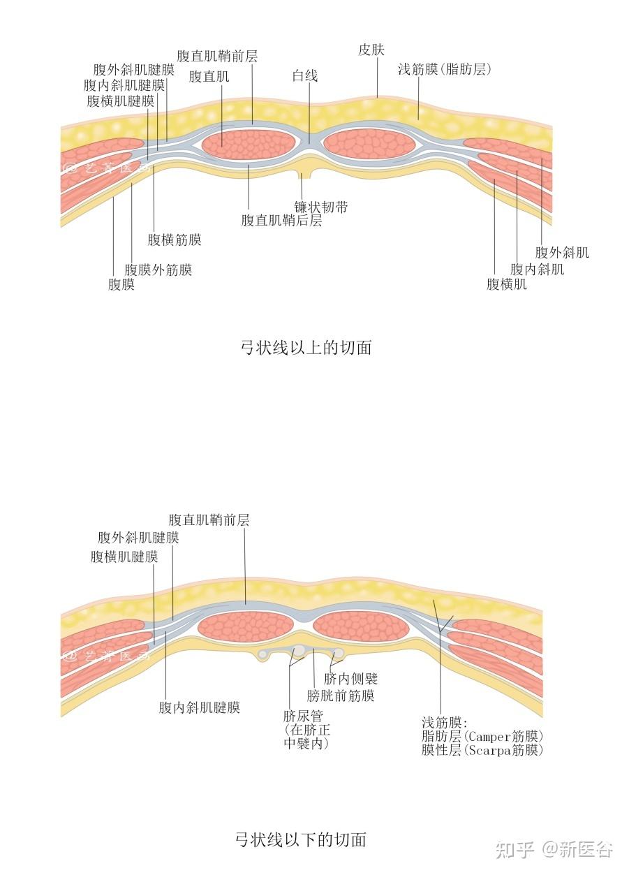 疝气手术步骤图解图片