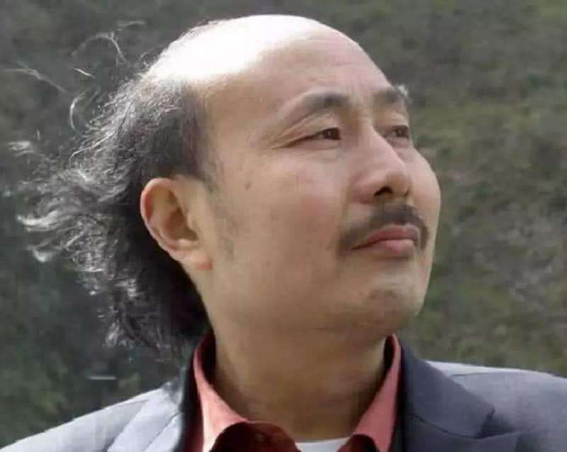 男性秃顶意味着什么? - 知乎