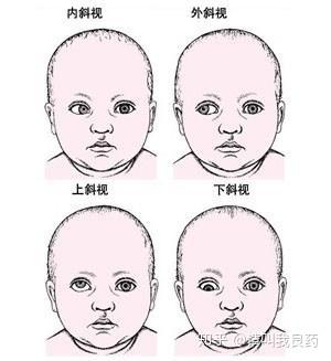 「视力篇」新生儿多久能看到东西？避免斗鸡眼的方法！ - 知乎
