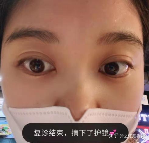 杭州近视手术晶体植入矫正度数是多少?有没有后遗症?安全吗?可逆吗?