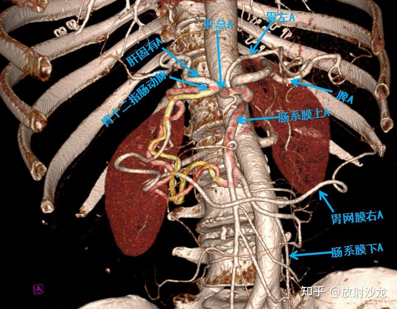 腹部增强ct小心漏诊这个病