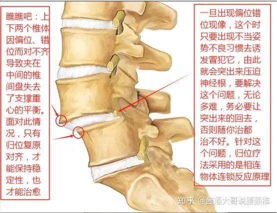 颈椎的钩椎关节位置图图片