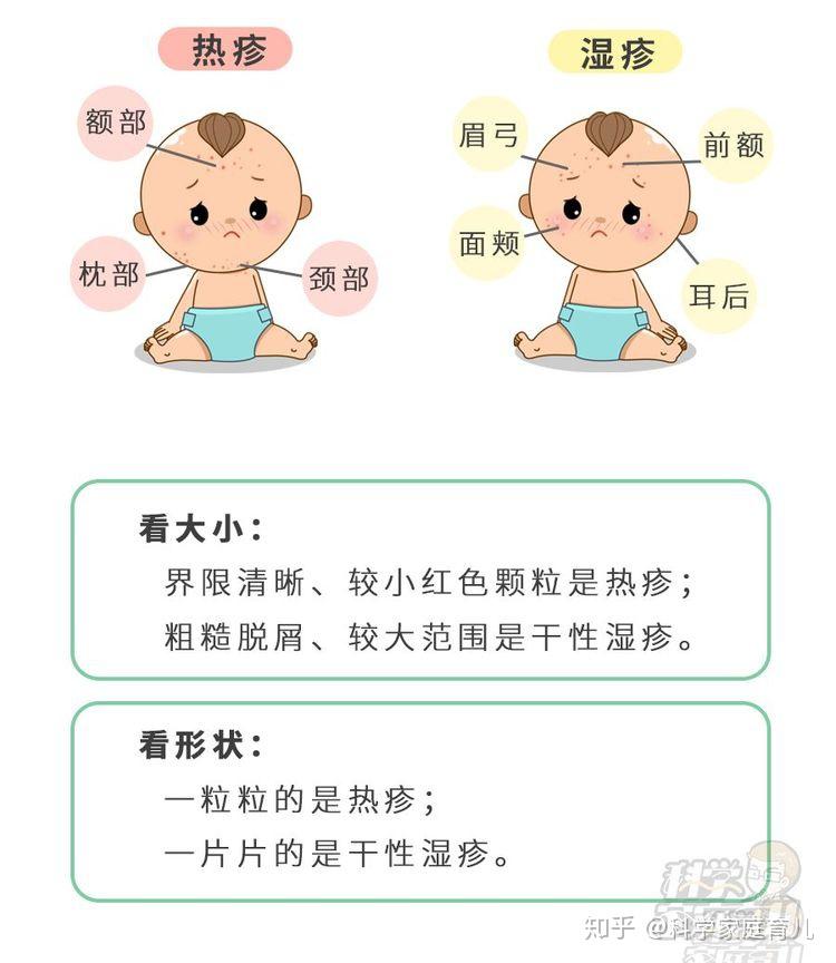 不少妈妈会把热疹和干性湿疹混淆，干性湿疹高发，记住几点就够了 - 知乎