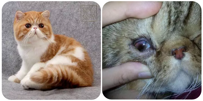 二,哪些原因会导致眼睑内翻?