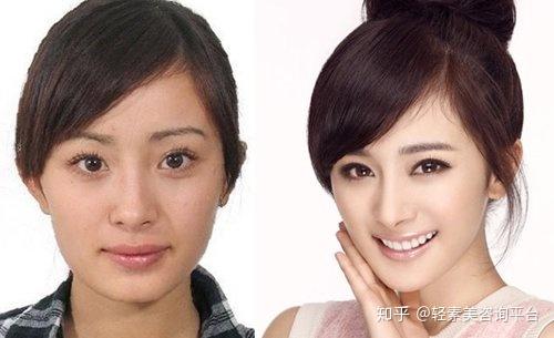 你们是否能接受自己的另一半整形? - 知乎