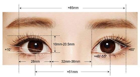 双眼皮类型以及术式有哪些