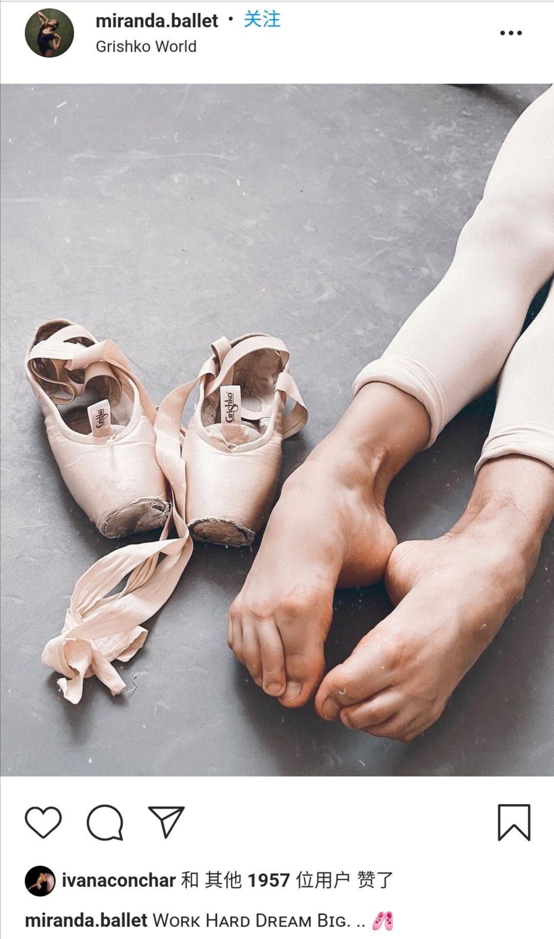 芭蕾舞演员的脚会变成什么样