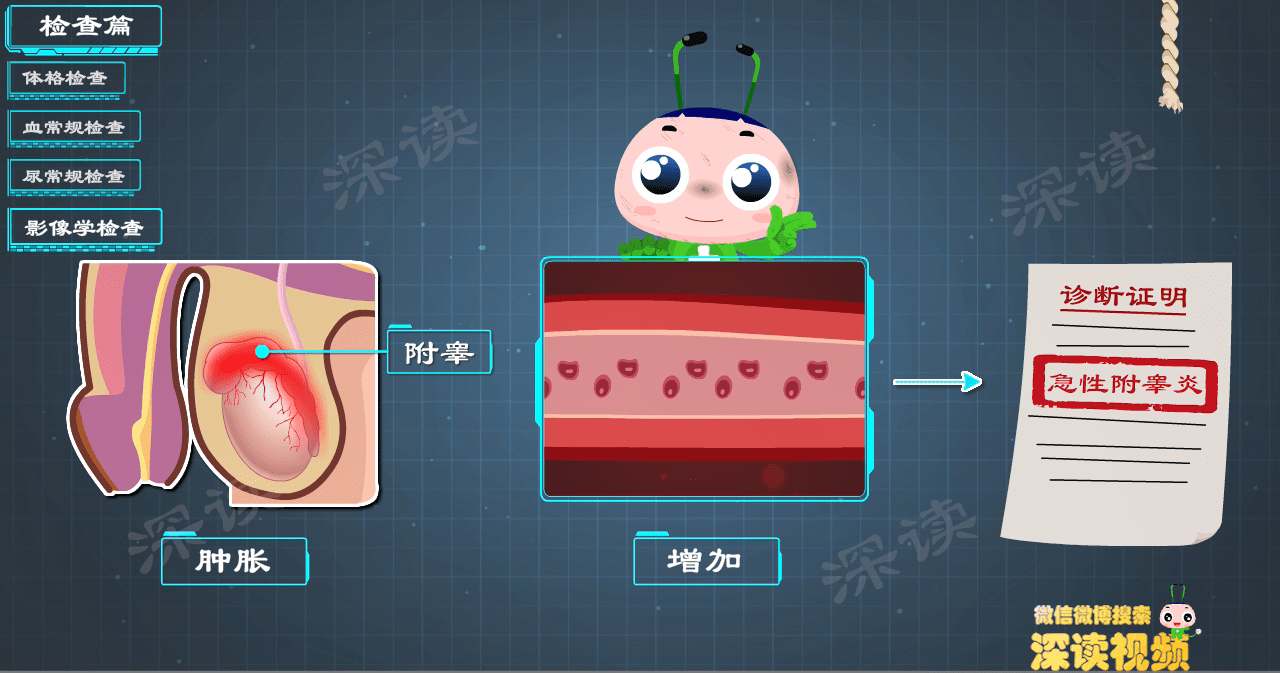 蛋疼腫脹該咋辦細數附睪炎治療那些坑小心毀於一蛋