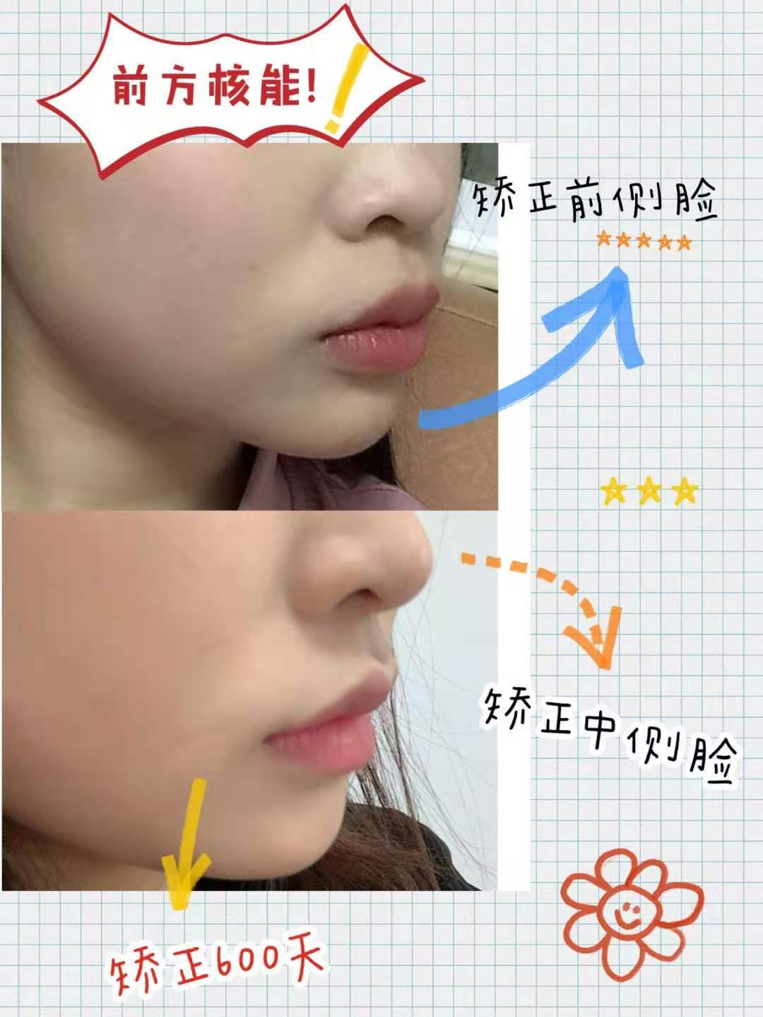 麦芽汁英语 麦芽汁英语
