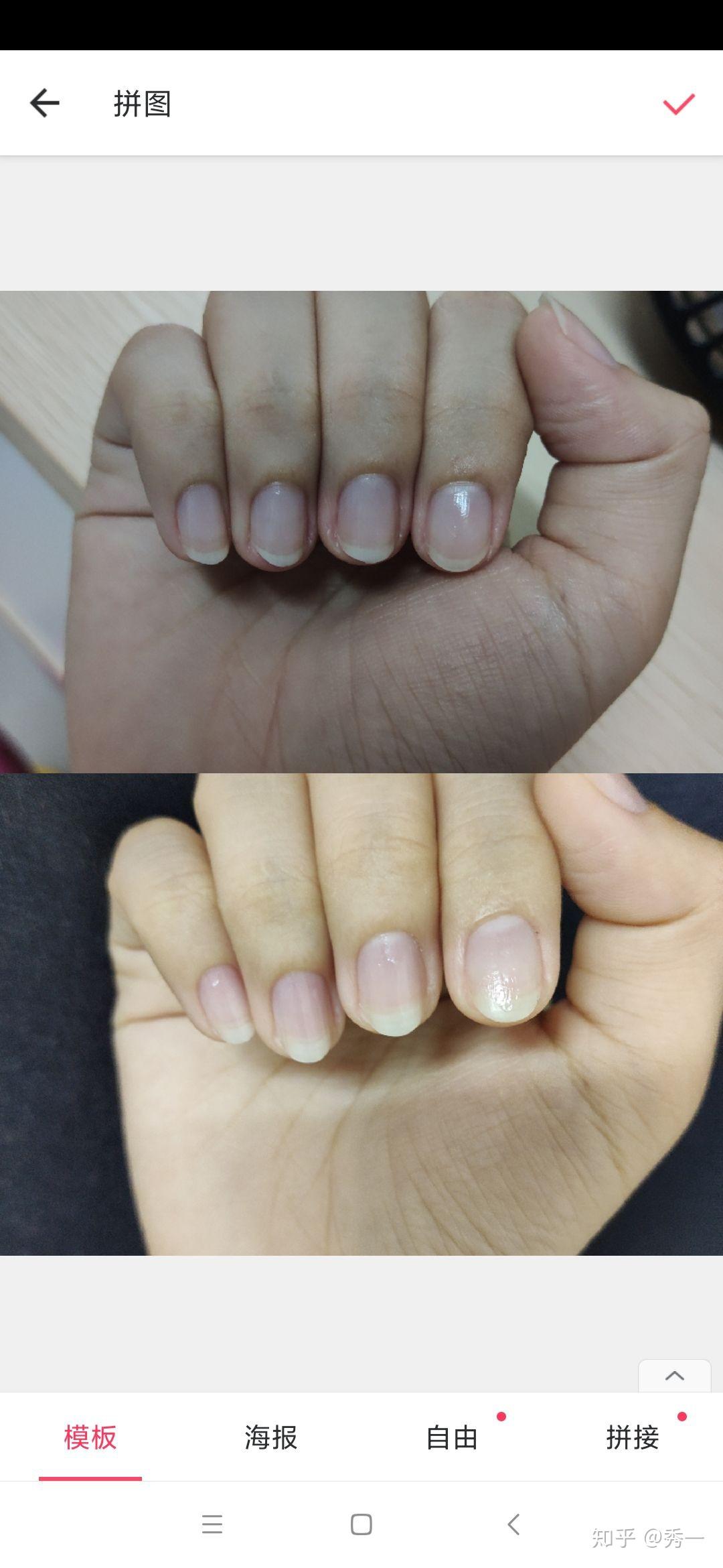 记录养指甲游离线的帖子 - 知乎