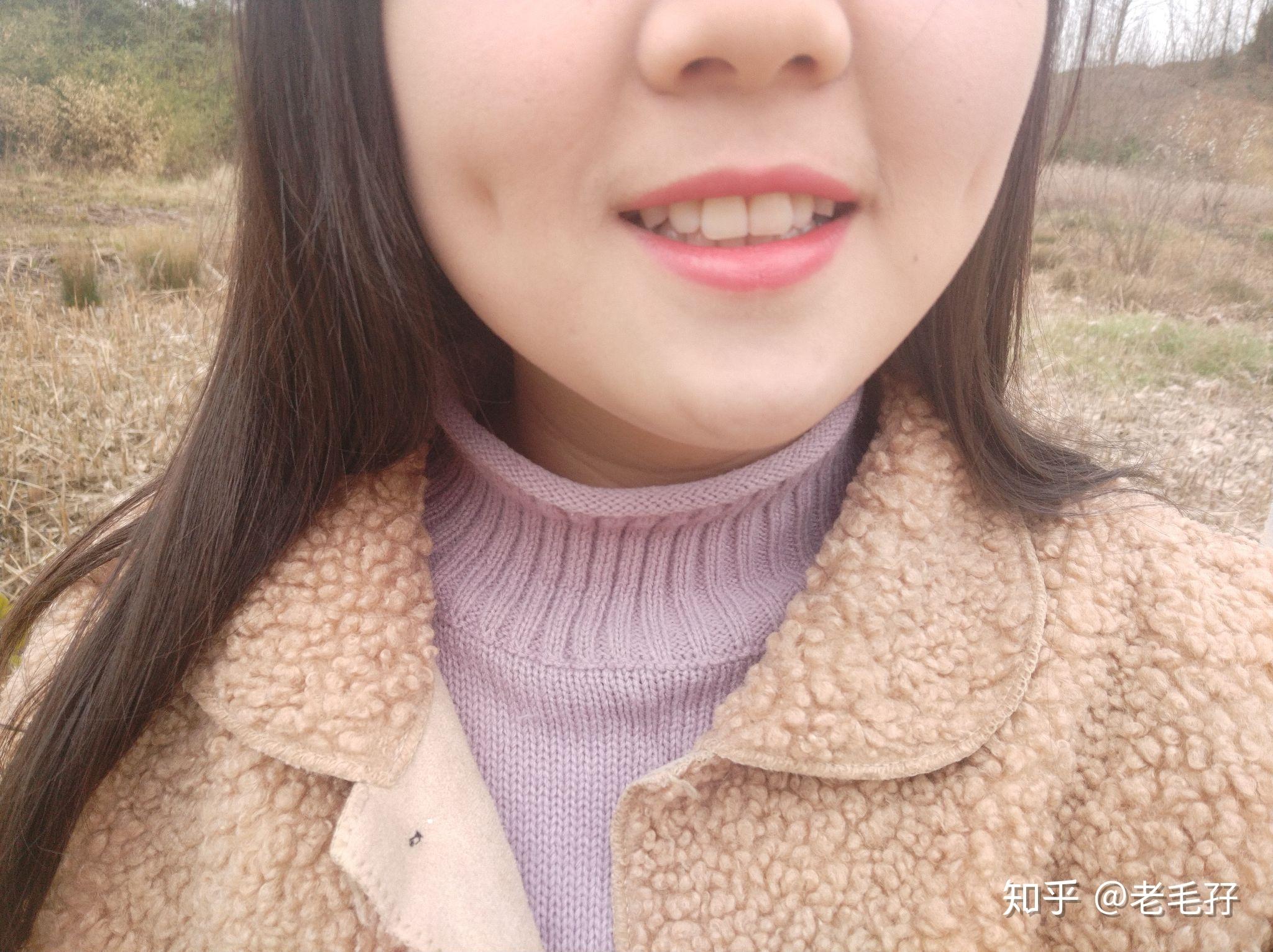 我抿嘴的时候酒窝才会出现笑的时候没有这是为什么