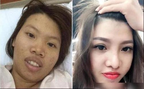 当初为嫁给有钱人,整容成功的越南丑姑娘,生下女儿后她如今咋样