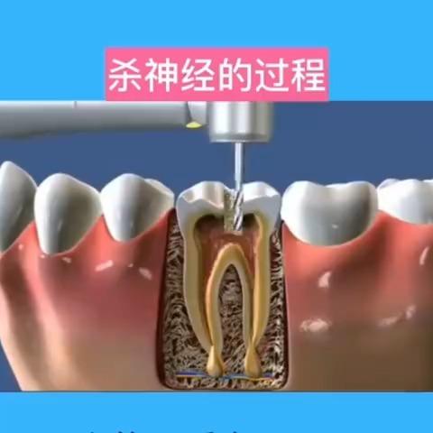 乳牙蛀牙不知道的迷