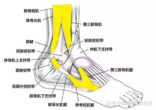 足底最可怕的伤 第五趾骨疲劳性骨折 知乎