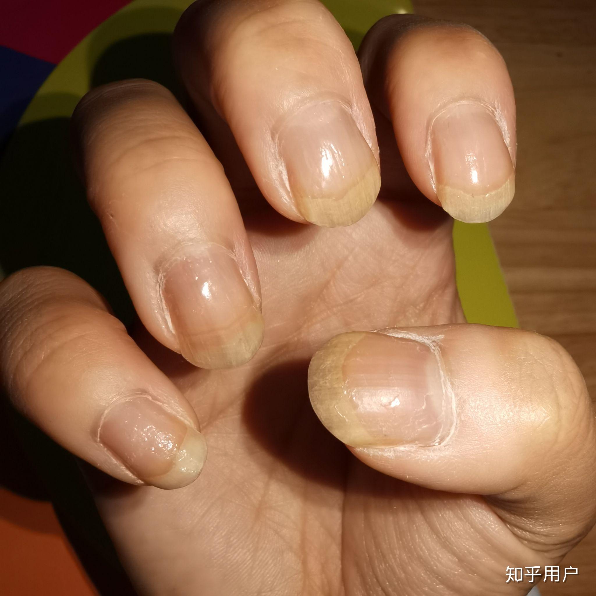 指甲很短而且很丑怎么办? - 知乎